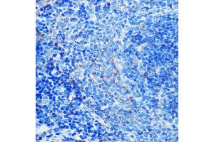 Immunohistochemistry of paraffin-embedded mouse spleen using CD23 Rabbit mAb (ABIN7267160) at dilution of 1:100 (40x lens).