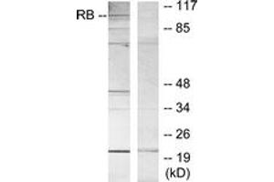 Western blot analysis of extracts from MOLT cells, using Retinoblastoma (Ab-807) Antibody. (Retinoblastoma Protein (Rb) anticorps  (AA 781-830))