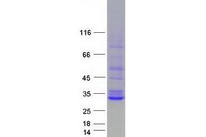 Validation with Western Blot