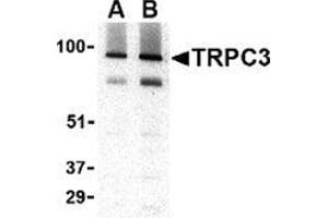 Western blot analysis of TRPC3 in human brain tissue lysate with this product at (A) 1 and (B) 2 μg/ml. (TRPC3 anticorps  (C-Term))