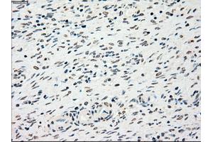 Immunohistochemical staining of paraffin-embedded liver tissue using anti-CHEK2mouse monoclonal antibody. (CHEK2 anticorps)