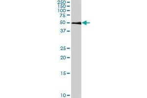SMAD1 monoclonal antibody (M03), clone 2E9.