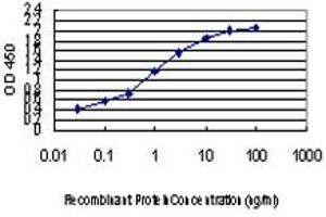 Detection limit for recombinant GST tagged ZIC4 is approximately 0. (ZIC4 anticorps  (AA 249-319))
