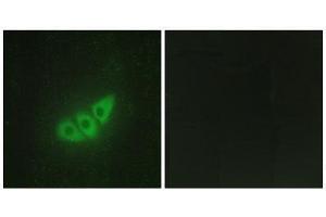 Immunofluorescence (IF) image for anti-Eukaryotic Translation Initiation Factor 2-alpha Kinase 3 (EIF2AK3) (N-Term) antibody (ABIN1850024) (PERK anticorps  (N-Term))