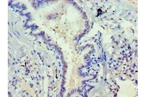 Immunohistochemistry of paraffin-embedded human lung tissue using ABIN7168752 at dilution of 1:100 (DVL2 anticorps  (AA 1-240))