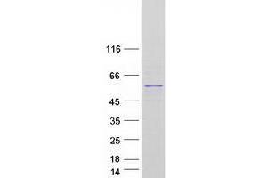 Validation with Western Blot