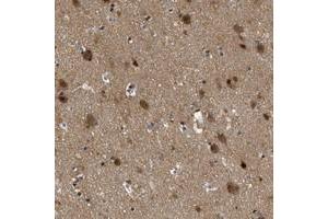 Immunohistochemical staining of human cerebral cortex with ZBTB11 polyclonal antibody  shows cytoplasmic positivity in neuronal cells at 1:20-1:50 dilution. (ZBTB11 anticorps)