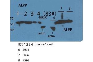 Western Blotting (WB) image for anti-Placental Alkaline Phosphatase (ALPP) (N-Term) antibody (ABIN3187883)