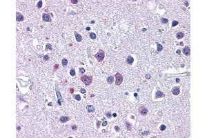 Anti-CACNA1I / Cav3.