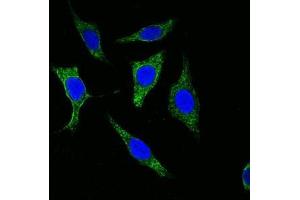 Confocal immunofluorescence analysis of methanol-fixed Eca-109 cells using Cytokeratin (Pan) antibody (green), showing cytoplasmic localization. (pan Keratin anticorps)