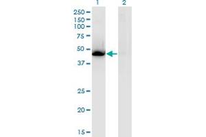 Western Blot analysis of NR1H3 expression in transfected 293T cell line by NR1H3 monoclonal antibody (M08), clone 3E9.