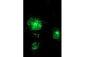 Anti-APP mouse monoclonal antibody (ABIN2455923) immunofluorescent staining of COS7 cells transiently transfected by pCMV6-ENTRY APP (RC221339). (APP anticorps)