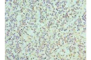 Immunohistochemistry of paraffin-embedded human spleen tissue using ABIN7145108 at dilution of 1:100 (ATG16L1 anticorps  (AA 90-300))