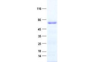 Validation with Western Blot
