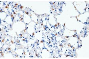 Immunohistochemistry of paraffin-embedded Mouse lung using SFTPC Polyclonal Antibody at dilution of 1:200 (40x lens).