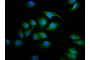 Immunofluorescence staining of A549 cells with ABIN7170898 at 1:100, counter-stained with DAPI. (Sdhaf2 anticorps  (AA 30-166))
