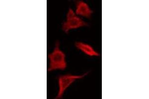 ABIN6266583 staining HepG2 by IF/ICC. (SCGB2A1 anticorps  (Internal Region))