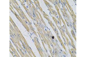 Immunohistochemistry of paraffin-embedded Rat heart using PRNP Polyclonal Antibody at dilution of 1:100 (40x lens).