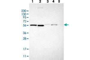 Western blot analysis of Lane 1: RT-4, Lane 2: U-251 MG, Lane 3: Human Plasma, Lane 4: Liver, Lane 5: Tonsil with TMEM194A polyclonal antibody  at 1:250-1:500 dilution. (TMEM194A anticorps)