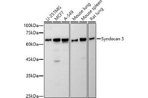 Western blot analysis of extracts of various cell lines, using Syndecan 3 antibody (ABIN7270679) at 1:500 dilution. (SDC3 anticorps)