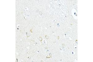 Immunohistochemistry of paraffin-embedded human brain using LRRC59 Rabbit pAb  at dilution of 1:100 (40x lens).