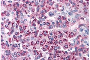 Human Pancreas: Formalin-Fixed, Paraffin-Embedded (FFPE) (TLR3 anticorps  (AA 514-657))