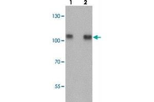 Western blot analysis of TRIM24 in EL4 cell lysate with TRIM24 polyclonal antibody  at (lane 1) 0. (TRIM24 anticorps  (Internal Region))