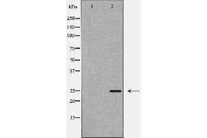 Western blot analysis of CHOP expression in Jurkat cell lysate,The lane on the left is treated with the antigen-specific peptide. (DDIT3 anticorps  (Internal Region))