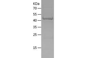 Western Blotting (WB) image for Outer Dense Fiber of Sperm Tails 3 (ODF3) (AA 1-254) protein (His-IF2DI Tag) (ABIN7124284) (ODF3 Protein (AA 1-254) (His-IF2DI Tag))