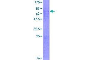 Image no. 1 for B-Cell CLL/lymphoma 6, Member B (BCL6B) (AA 1-480) protein (GST tag) (ABIN7536639)