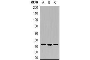Western blot analysis of Layilin expression in U251 (A), K562 (B), A549 (C) whole cell lysates. (Layilin anticorps)