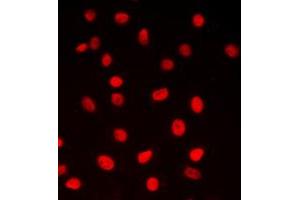 Immunofluorescent analysis of CREB staining in MCF7 cells. (CREB1 anticorps  (Center))