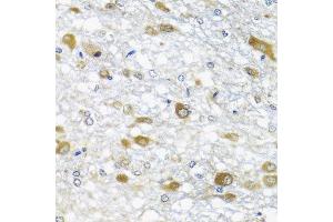 Immunohistochemistry of paraffin-embedded rat brain using DDX39A antibody at dilution of 1:100 (x40 lens). (DDX39 anticorps)
