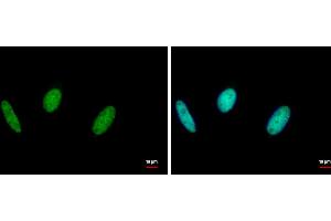 ICC/IF Image RAD18 antibody [N1C1] detects RAD18 protein at nucleus by immunofluorescent analysis. (RAD18 anticorps  (Center))