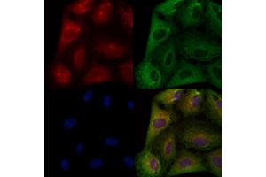 ABIN6259163 and ABIN6274159 staining  cells by IF/ICC. (TACSTD2 anticorps  (Internal Region))