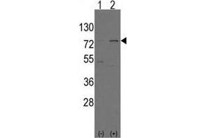 Western blot analysis of Nrf2(Nfe2l2)(arrow) using rabbit polyclonal Nrf2(Nfe2l2) Antibody (N-term) .