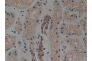 Detection of CK1 in Human Kidney Tissue using Polyclonal Antibody to Cytokeratin 1 (CK1)