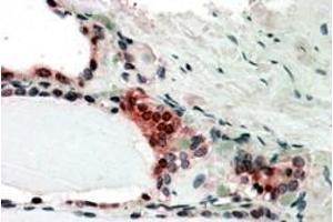 In paraffin embedded Human Thyroid Gland shows nclear and cytoplasm staining in activated epithelial cells Recommended concentration, 3-5µg/ml. (COPS2 anticorps  (C-Term))