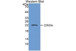 Detection of Recombinant CD276, Mouse using Polyclonal Antibody to Cluster Of Differentiation 276 (CD276)