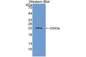 Detection of Recombinant CD276, Mouse using Polyclonal Antibody to Cluster Of Differentiation 276 (CD276) (CD276 anticorps  (AA 47-213))