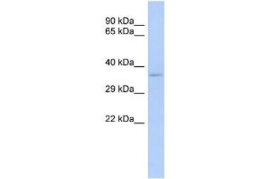 WB Suggested Anti-TRADD Antibody Titration:  0. (TRADD anticorps  (Middle Region))