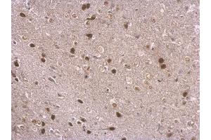 IHC-P Image NPAS1 antibody detects NPAS1 protein at nucleus on mouse middle brain by immunohistochemical analysis.