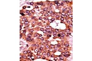 Image no. 2 for anti-Cell Division Cycle 6 Homolog (S. Cerevisiae) (CDC6) (pSer54) antibody (ABIN358103)