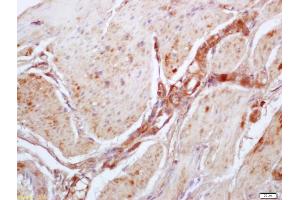 Formalin-fixed and paraffin embedded mouse stomach labeled with Anti-Phospho-MYPT1(Thr696) Polyclonal Antibody, Unconjugated (ABIN744068) at 1:200 followed by conjugation to the secondary antibody and DAB staining (PPP1R12A anticorps  (pThr696))