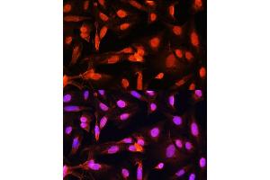 Immunofluorescence analysis of U20S cells using SGOL1 antibody (ABIN7270288) at dilution of 1:100.