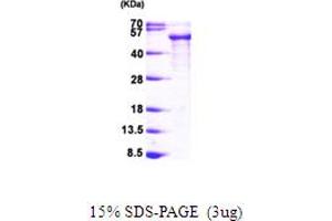 SDS-PAGE (SDS) image for tau Protein (AA 1-352) protein (His tag) (ABIN667803) (tau Protein (AA 1-352) (His tag))