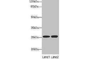 Western blot All lanes: EEF1AKMT1 antibody at 10 μg/mL Lane 1: Jurkat whole cell lysate Lane 2: 293T whole cell lysate Secondary Goat polyclonal to rabbit IgG at 1/10000 dilution Predicted band size: 25 kDa Observed band size: 25 kDa (EEF1A Lysine Methyltransferase 1 (EEF1AKMT1) (AA 2-214) anticorps)