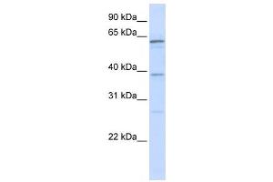 Western Blotting (WB) image for anti-RNA Binding Motif Protein 39 (RBM39) antibody (ABIN2458513) (RBM39 anticorps)