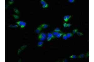 Immunofluorescence staining of Hela cells with ABIN7152472 at 1:100, counter-stained with DAPI. (FBXL2 anticorps  (AA 1-423))