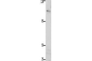 Western Blotting (WB) image for anti-PTK2 Protein tyrosine Kinase 2 (PTK2) antibody (ABIN2425840) (FAK anticorps)